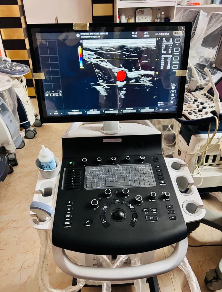 GE Versana Balance Ultrasound System