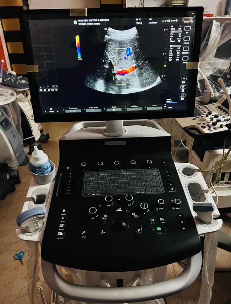 GE Versana Balance Ultrasound System