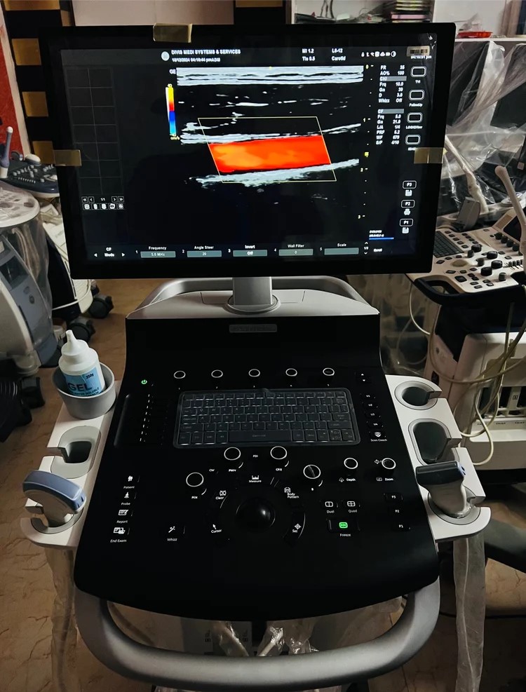 GE Versana Balance Ultrasound System